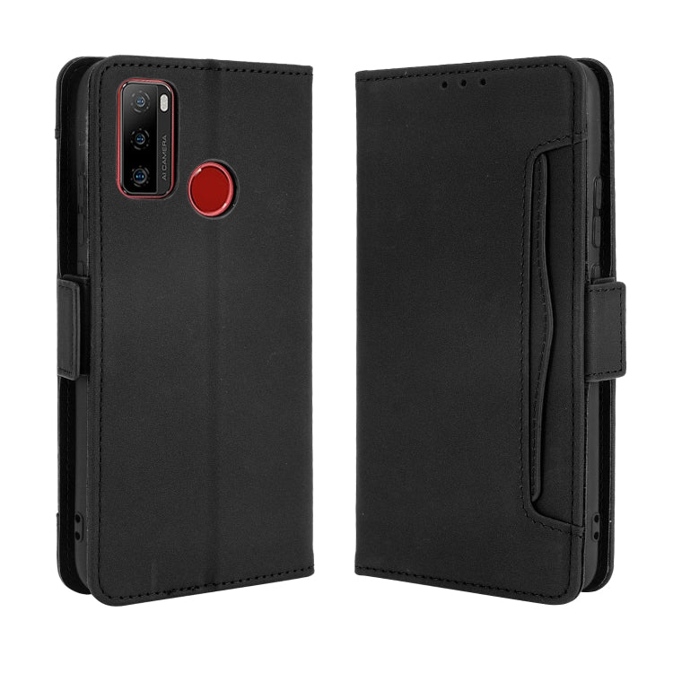 For Ulefone Note 10 Skin Feel Calf Pattern Horizontal Flip Leather Case with Holder & Card Slots & Photo Frame(Black) - Ulefone Cases by PMC Jewellery | Online Shopping South Africa | PMC Jewellery | Buy Now Pay Later Mobicred