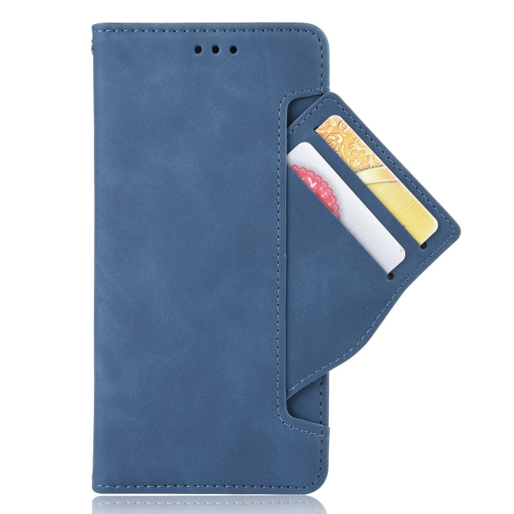 For Blackview A90 Skin Feel Calf Pattern Horizontal Flip Leather Case with Holder & Card Slots & Photo Frame(Blue) - More Brand by PMC TechLife | Online Shopping South Africa | PMC TechLife | Buy Now Pay Later Mobicred