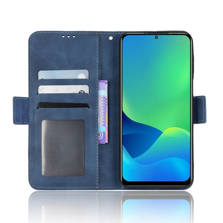 For Ulefone Note 13P Skin Feel Calf Pattern Leather Phone Case(Blue) - Ulefone Cases by PMC Jewellery | Online Shopping South Africa | PMC Jewellery | Buy Now Pay Later Mobicred