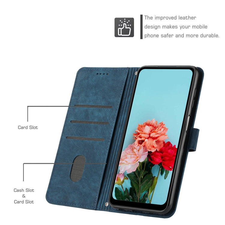 For Infinix Note 40 4G Skin Feel Stripe Pattern Leather Phone Case with Lanyard(Blue) - Infinix Cases by PMC TechLife | Online Shopping South Africa | PMC TechLife | Buy Now Pay Later Mobicred