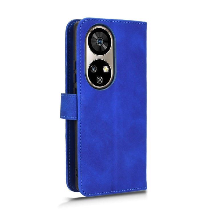 For Ulefone Note 17 Pro Skin Feel Magnetic Flip Leather Phone Case(Blue) - Ulefone Cases by PMC Jewellery | Online Shopping South Africa | PMC Jewellery | Buy Now Pay Later Mobicred