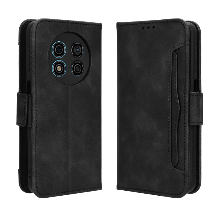 For Ulefone Note 15 Skin Feel Calf Texture Card Slots Leather Phone Case(Black) - Ulefone Cases by PMC Jewellery | Online Shopping South Africa | PMC Jewellery | Buy Now Pay Later Mobicred