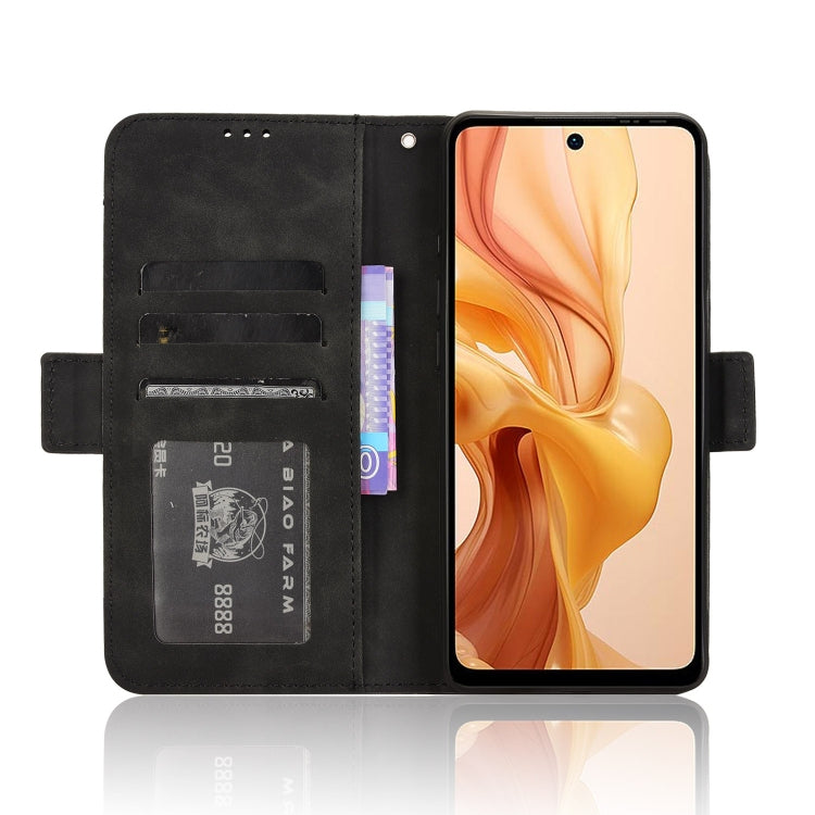 For Ulefone Note 18 Ultra Skin Feel Calf Texture Card Slots Leather Phone Case(Black) - Ulefone Cases by PMC Jewellery | Online Shopping South Africa | PMC Jewellery | Buy Now Pay Later Mobicred