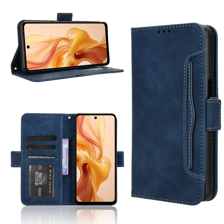 For Ulefone Note 18 Ultra Skin Feel Calf Texture Card Slots Leather Phone Case(Blue) - Ulefone Cases by PMC Jewellery | Online Shopping South Africa | PMC Jewellery | Buy Now Pay Later Mobicred