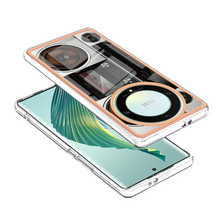 For Honor X9a / Magic5 Lite Electroplating Marble Dual-side IMD Phone Case(Retro Radio) - Honor Cases by PMC TechLife | Online Shopping South Africa | PMC TechLife | Buy Now Pay Later Mobicred
