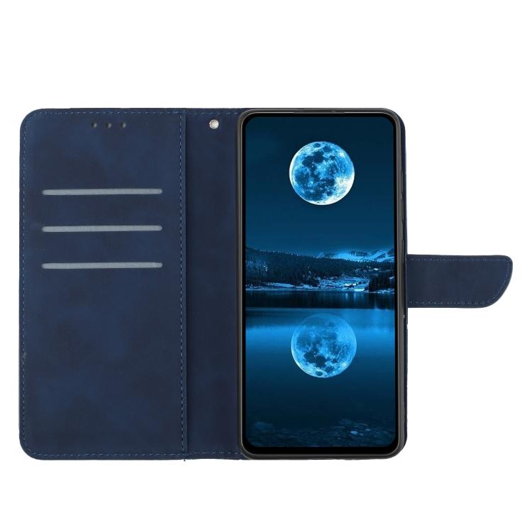 For Tecno Spark 40 Pro 4G Stitching Embossed Leather Phone Case(Blue) - free shipping - PMC TechLife - Order now!