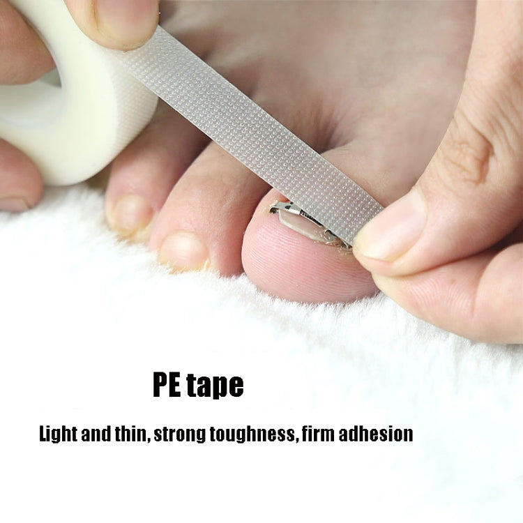 Orthopedic Buckle Toe Nail Groove Ingrown Nail Corrector, Style:No. 38, Specifications:Set - Corrector by PMC Jewellery | Online Shopping South Africa | PMC Jewellery