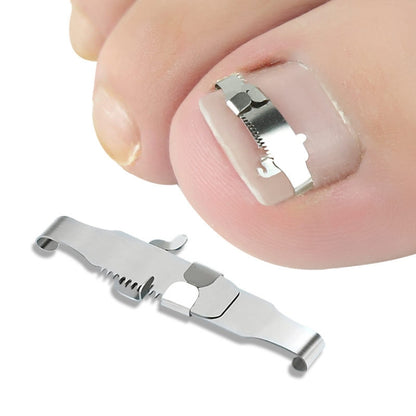 Orthopedic Buckle Toe Nail Groove Ingrown Nail Corrector, Style:No. 40, Specifications:Set - Corrector by PMC Jewellery | Online Shopping South Africa | PMC Jewellery